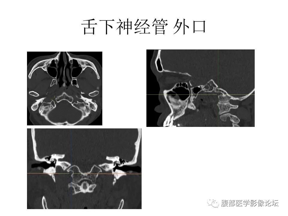 影像PPT - 【PPT】十二颅神孔道出-70