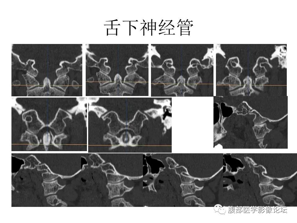 影像PPT - 【PPT】十二颅神孔道出-71