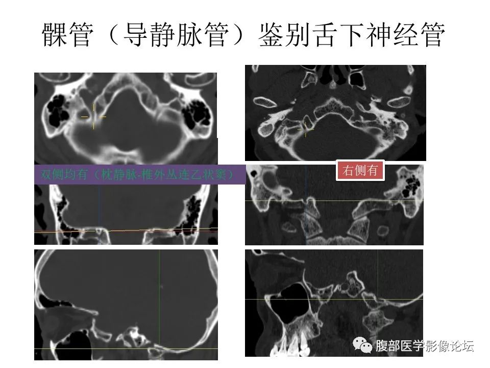 影像PPT - 【PPT】十二颅神孔道出-72