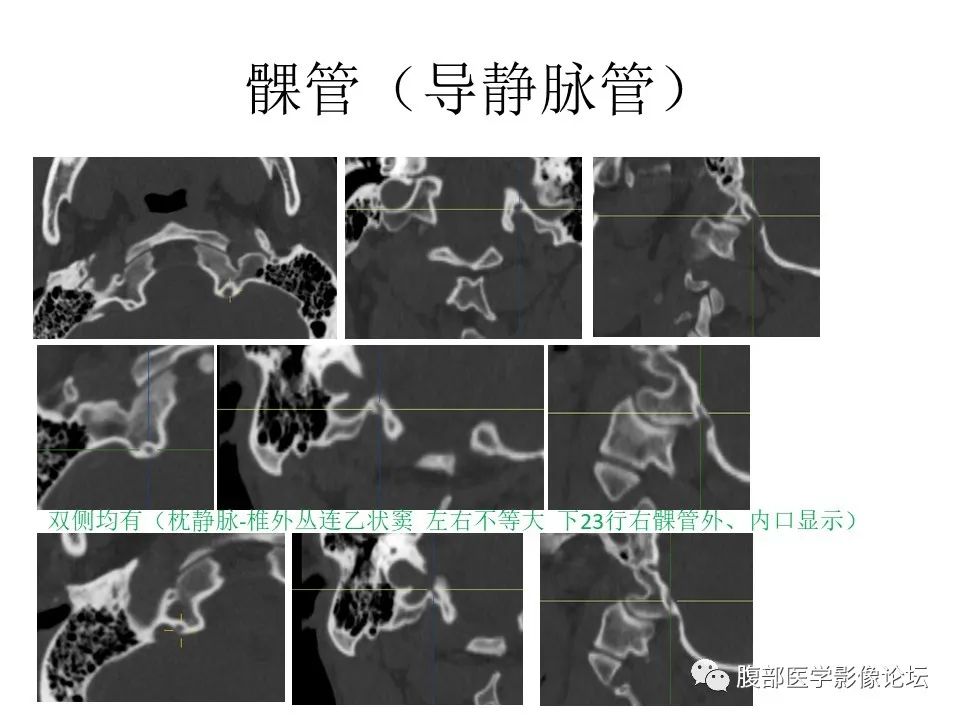 影像PPT - 【PPT】十二颅神孔道出-73