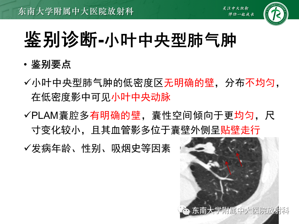 影像PPT - 【病例】肺淋巴管肌瘤病1例CT影像-21