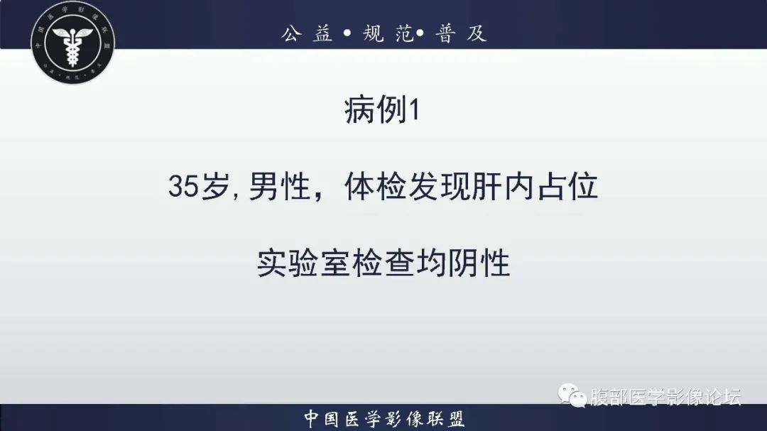 影像PPT - 【病例】肝脏血管平滑肌脂肪瘤1例CT及MR-2