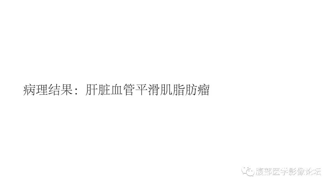 影像PPT - 【病例】肝脏血管平滑肌脂肪瘤1例CT及MR-8