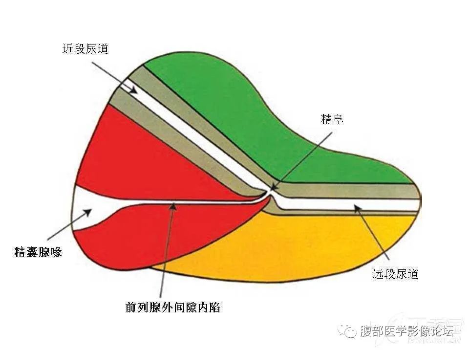 影像PPT - 【PPT】前列腺的解剖和功能-24
