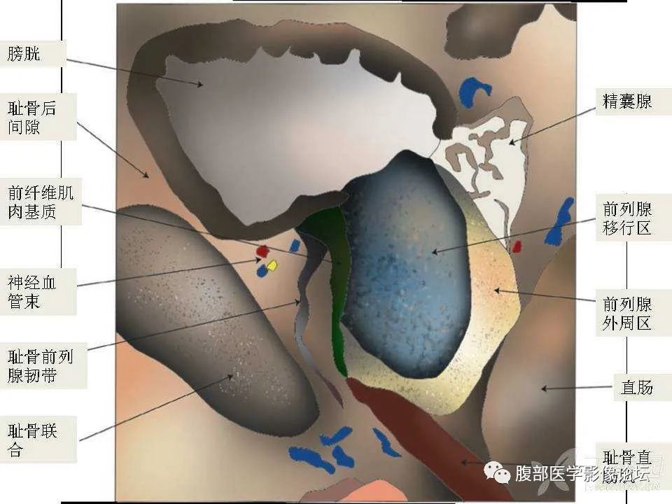 影像PPT - 【PPT】前列腺的解剖和功能-50