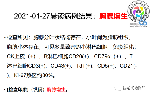影像PPT - 【病例】胸腺增生1例CT影像讨论-31 影像PPT - 【病例】胸腺增生1例CT影像讨论-31