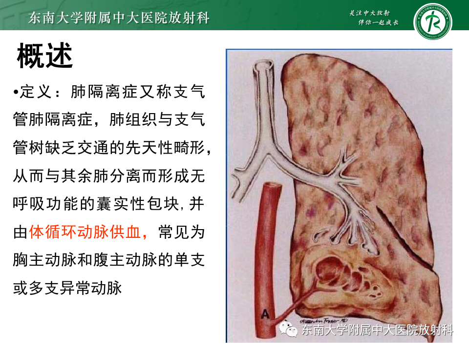影像PPT - 【PPT】肺隔离症-2