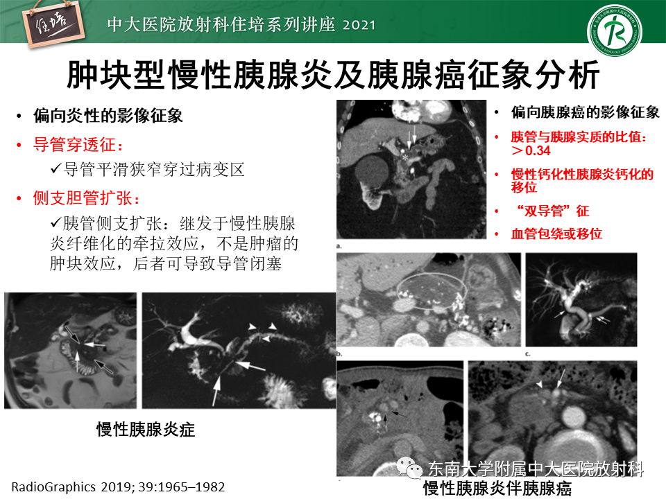 影像PPT - 【PPT】胰腺导管腺癌的影像诊断、评估及鉴别诊断-8