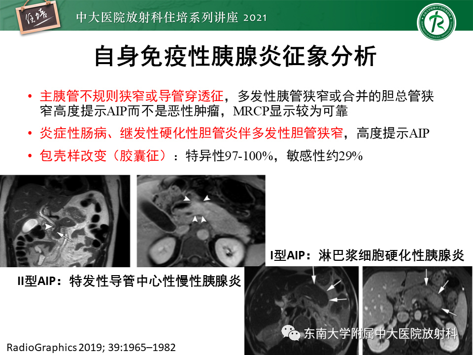 影像PPT - 【PPT】胰腺导管腺癌的影像诊断、评估及鉴别诊断-13