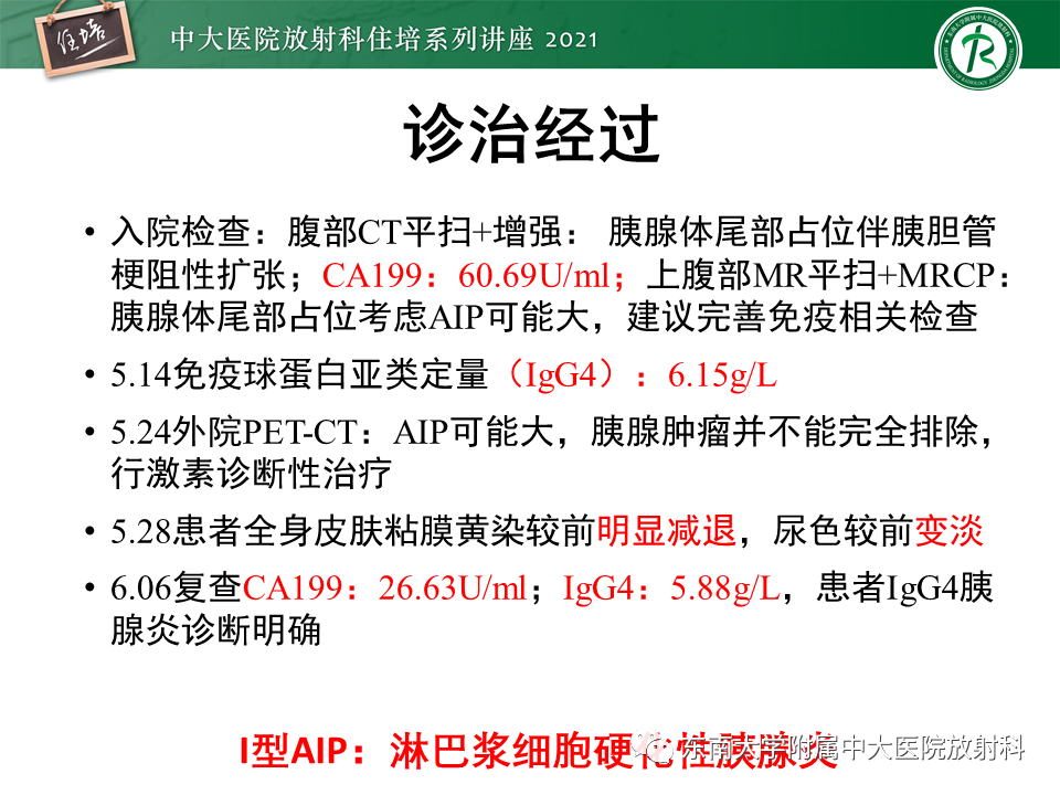 影像PPT - 【PPT】胰腺导管腺癌的影像诊断、评估及鉴别诊断-15