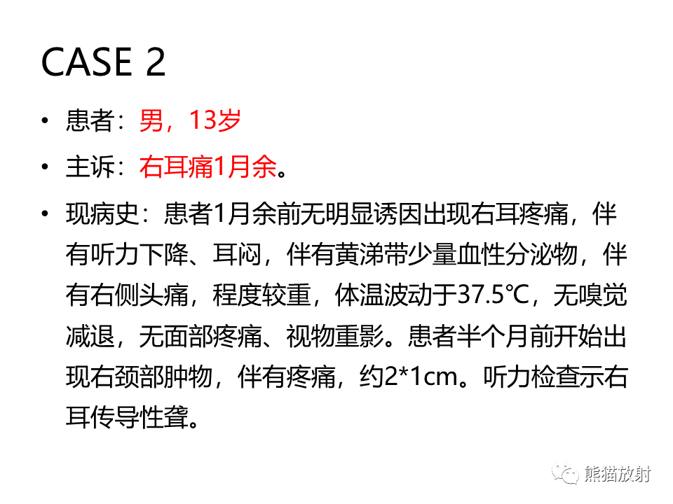影像PPT - 【病例】鼻咽纤维血管瘤VS鼻咽癌CT及MR影像-13