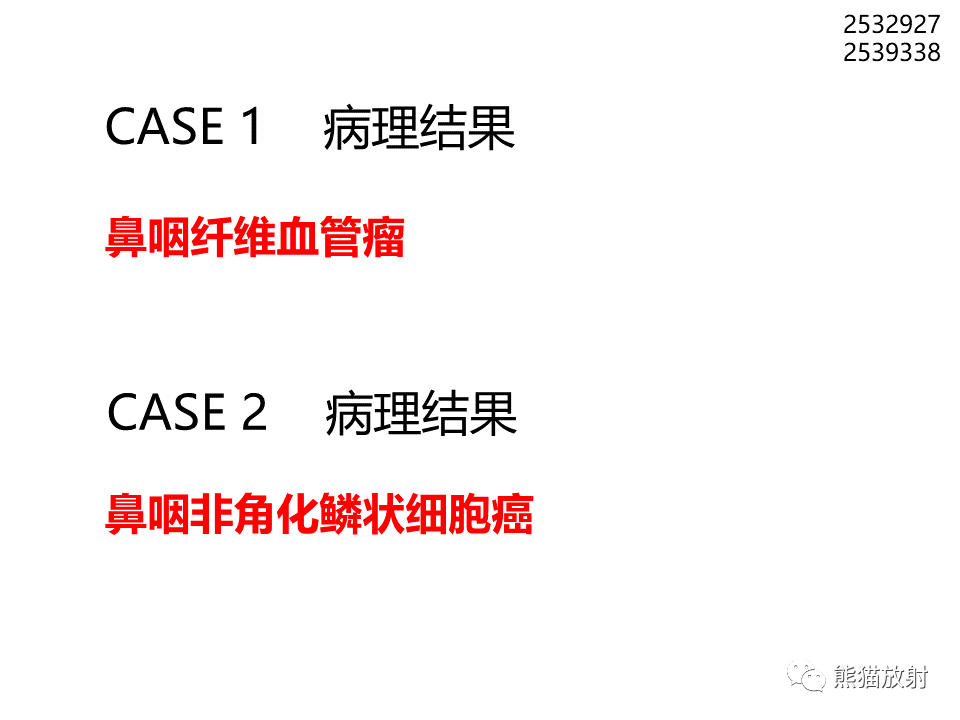 影像PPT - 【病例】鼻咽纤维血管瘤VS鼻咽癌CT及MR影像-21
