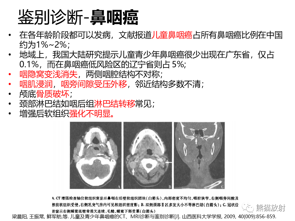 影像PPT - 【病例】鼻咽纤维血管瘤VS鼻咽癌CT及MR影像-24