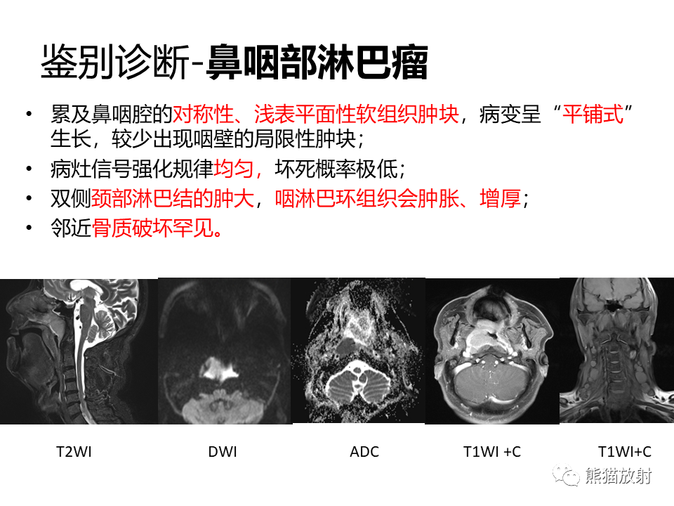 影像PPT - 【病例】鼻咽纤维血管瘤VS鼻咽癌CT及MR影像-25