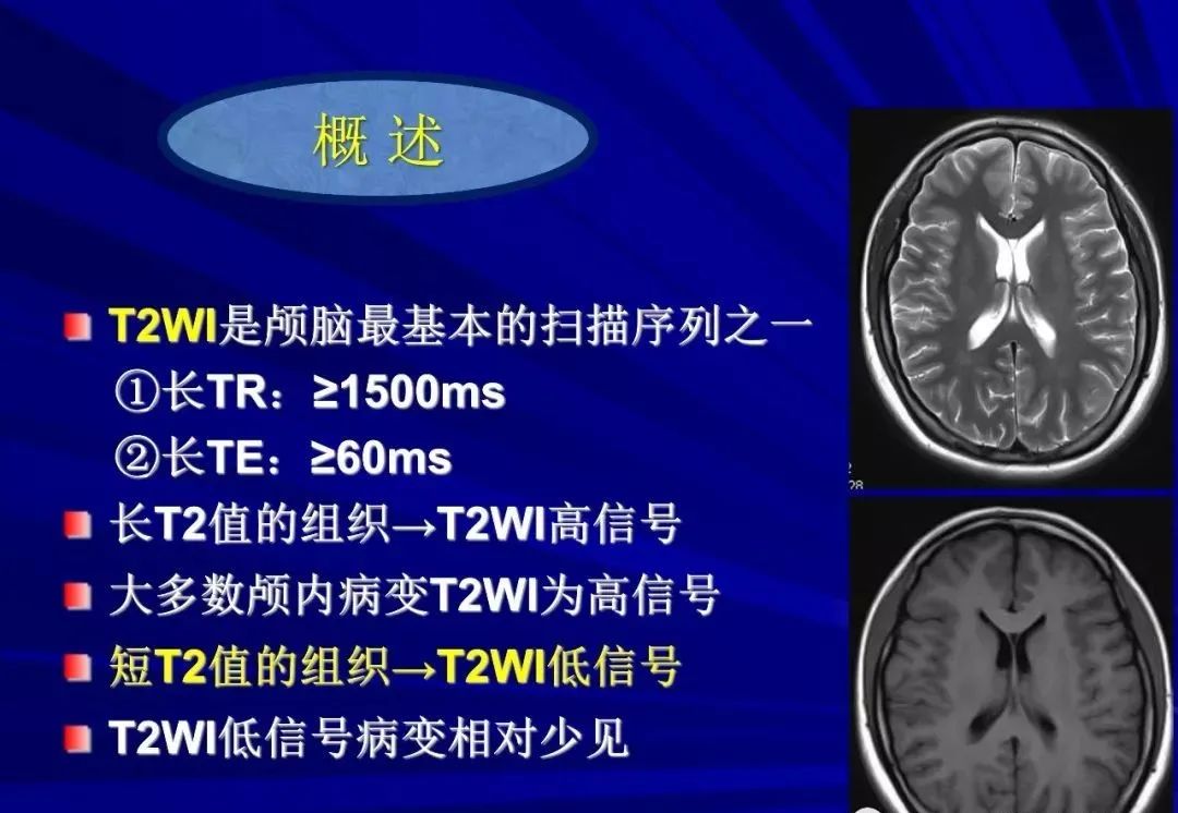 影像PPT - 【PPT】颅内短T2信号病变的影像学诊断及鉴别-2