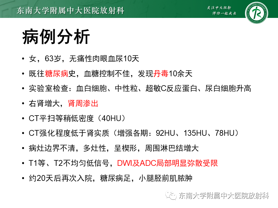 影像PPT - 【病例】肾盂肾炎1例CT及MR影像-3 影像PPT - 【病例】肾盂肾炎1例CT及MR影像-3