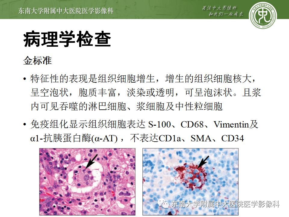 影像PPT - 【病例】罗道病1例MR影像-8