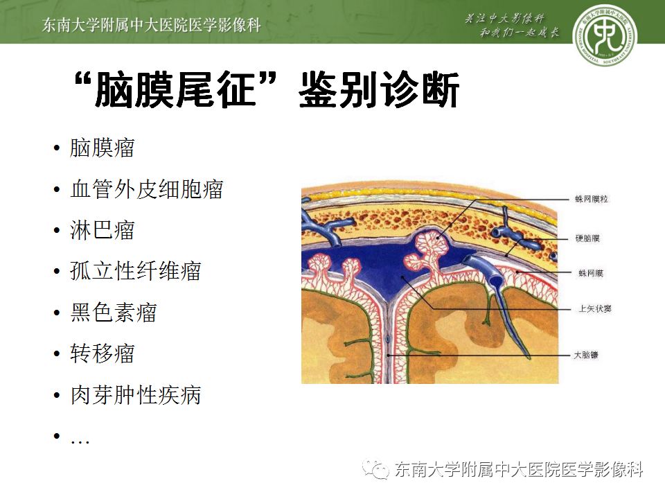 影像PPT - 【病例】罗道病1例MR影像-15