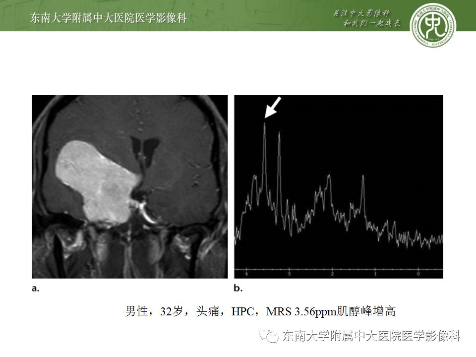 影像PPT - 【病例】罗道病1例MR影像-19