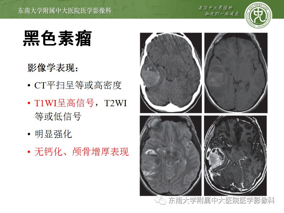 影像PPT - 【病例】罗道病1例MR影像-23