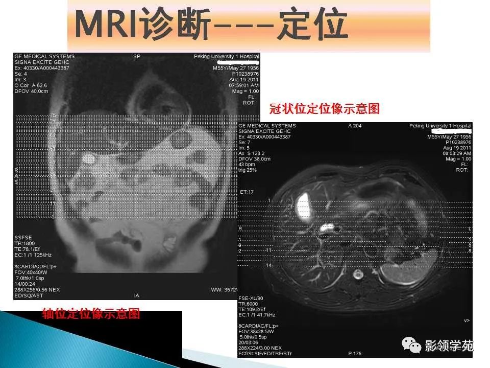 影像PPT - 【PPT】HCC影像诊断进展-12