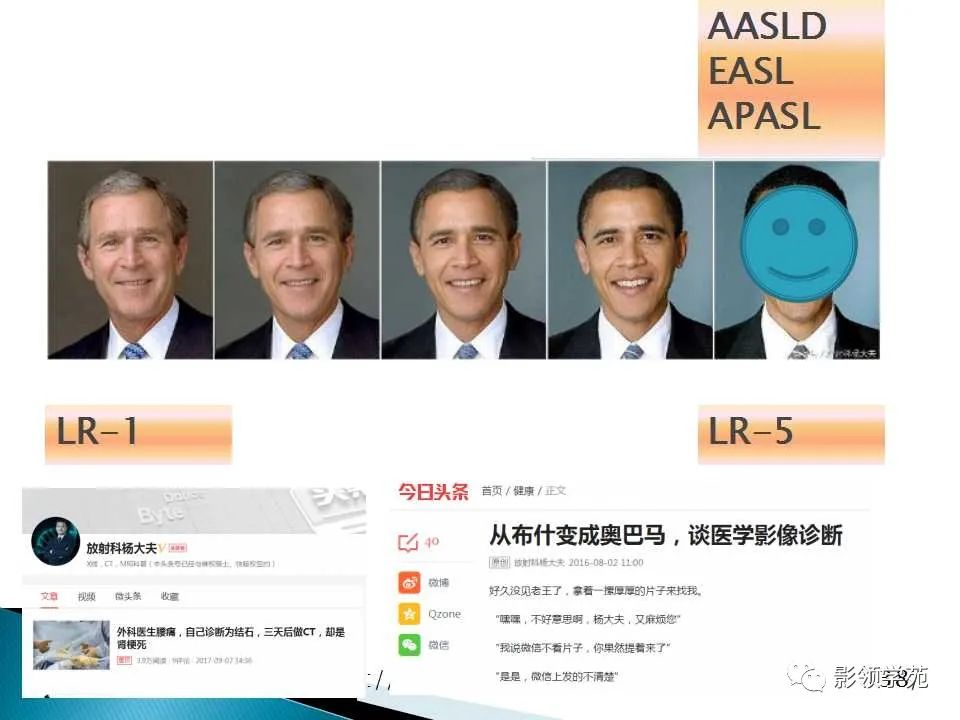 影像PPT - 【PPT】HCC影像诊断进展-26