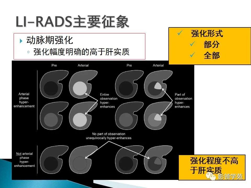 影像PPT - 【PPT】HCC影像诊断进展-36