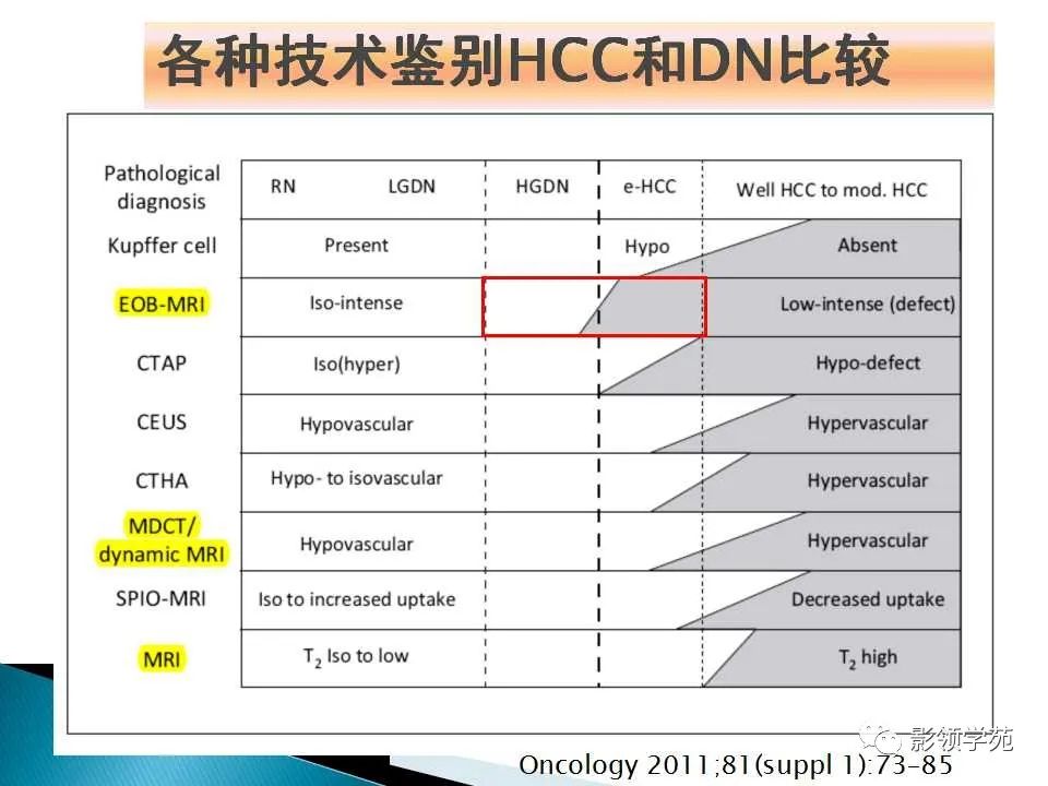 影像PPT - 【PPT】HCC影像诊断进展-62