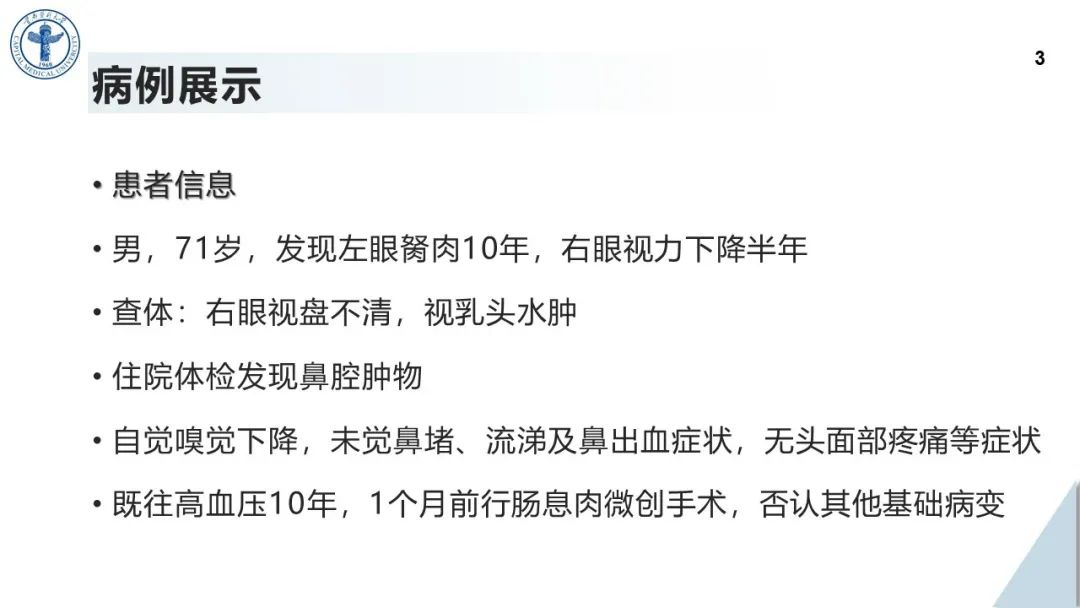 影像PPT - 【病例】鼻中隔腺样囊性癌1例CT及MR影像-2