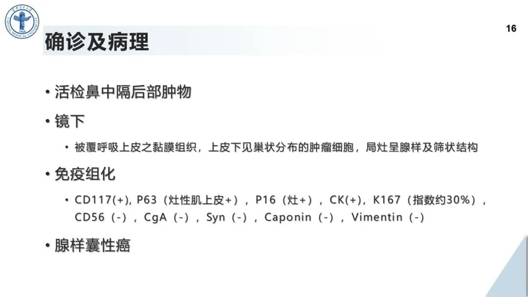 影像PPT - 【病例】鼻中隔腺样囊性癌1例CT及MR影像-15