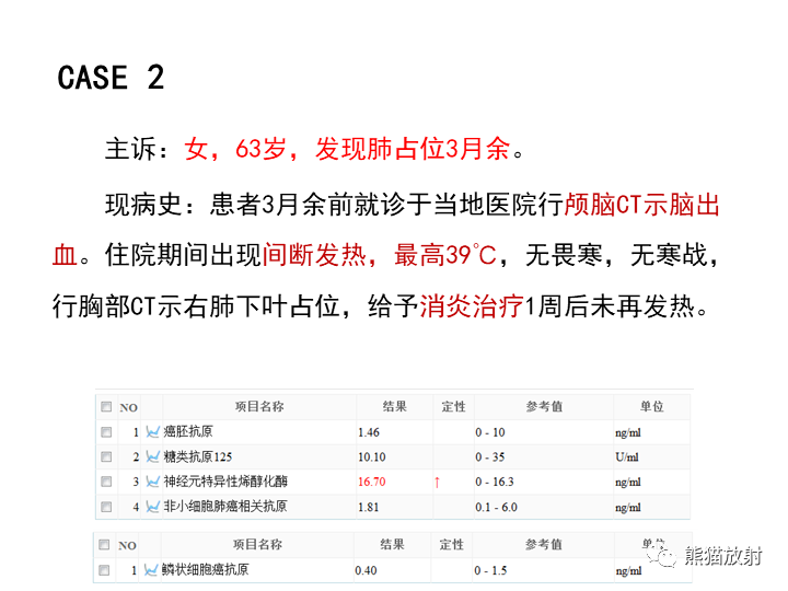 影像PPT - 【病例】肺泡性腺瘤VS原位腺癌-13