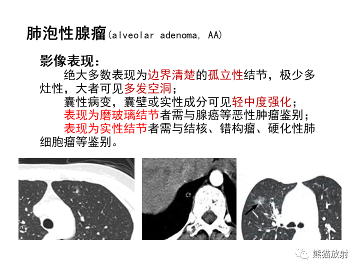 影像PPT - 【病例】肺泡性腺瘤VS原位腺癌-26