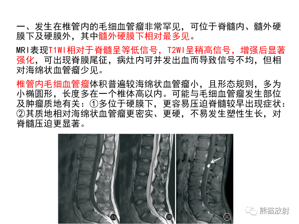 影像PPT - 【病例】椎管内髓外硬膜下血管瘤VS神经鞘瘤-19