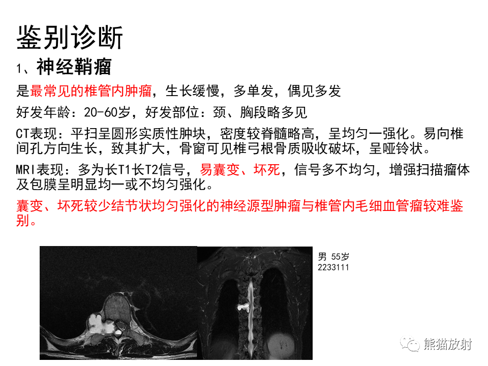 影像PPT - 【病例】椎管内髓外硬膜下血管瘤VS神经鞘瘤-23