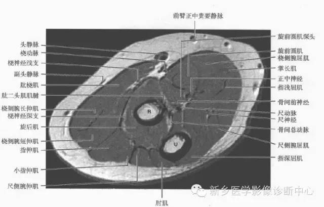 影像PPT - 前臂精细MR断层解剖标注-2