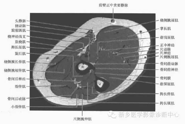 影像PPT - 前臂精细MR断层解剖标注-6