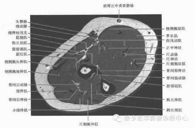 影像PPT - 前臂精细MR断层解剖标注-7