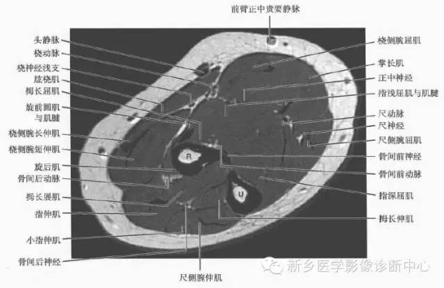 影像PPT - 前臂精细MR断层解剖标注-8