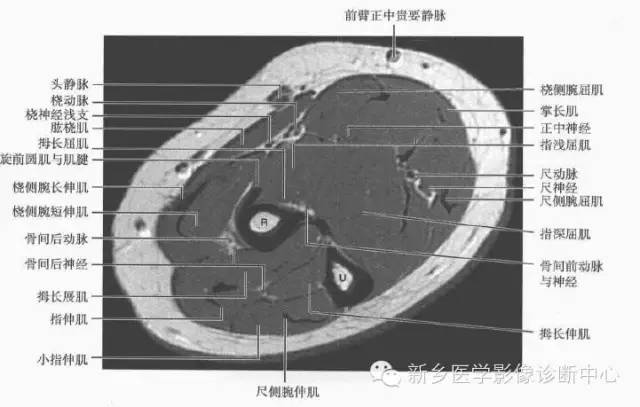 影像PPT - 前臂精细MR断层解剖标注-9