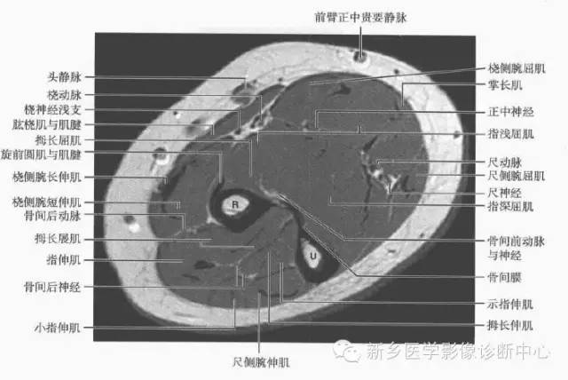 影像PPT - 前臂精细MR断层解剖标注-10