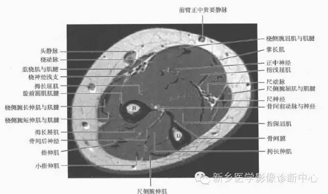 影像PPT - 前臂精细MR断层解剖标注-12