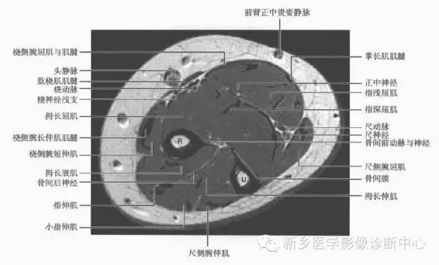 影像PPT - 前臂精细MR断层解剖标注-13