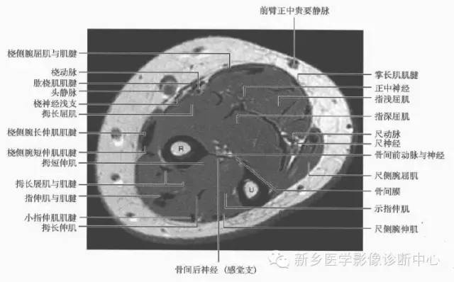 影像PPT - 前臂精细MR断层解剖标注-14