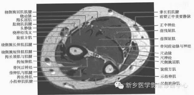 影像PPT - 前臂精细MR断层解剖标注-17