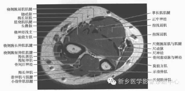 影像PPT - 前臂精细MR断层解剖标注-18