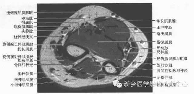 影像PPT - 前臂精细MR断层解剖标注-19