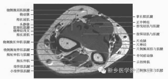 影像PPT - 前臂精细MR断层解剖标注-20