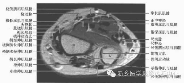 影像PPT - 前臂精细MR断层解剖标注-22