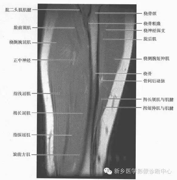 影像PPT - 前臂精细MR断层解剖标注-27