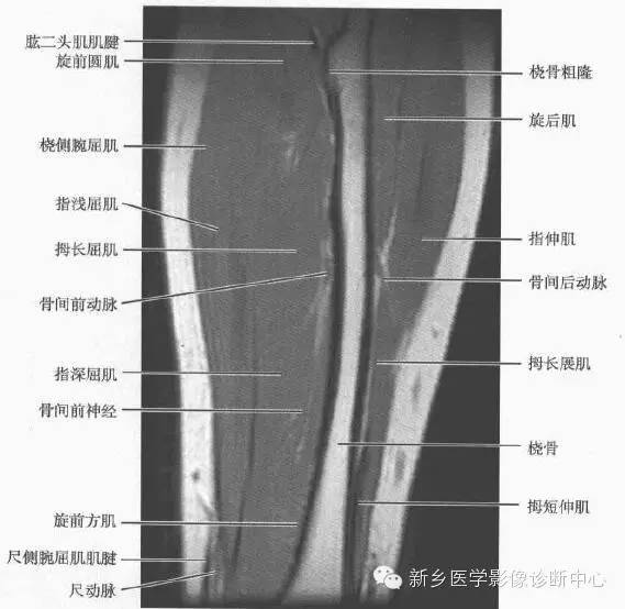 影像PPT - 前臂精细MR断层解剖标注-28